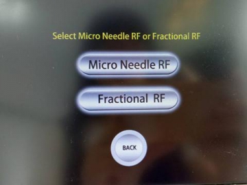 Portable Fractional RF Micro-Needling Device for Acne Scarring